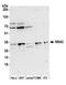 NSA2 Ribosome Biogenesis Factor antibody, A305-208A, Bethyl Labs, Western Blot image 
