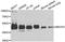 Methyl-CpG Binding Protein 2 antibody, A5694, ABclonal Technology, Western Blot image 