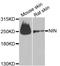 NADH dehydrogenase [ubiquinone] 1 beta subcomplex subunit 5, mitochondrial antibody, orb72152, Biorbyt, Western Blot image 