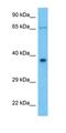 Ankyrin repeat domain-containing protein 2 antibody, orb327289, Biorbyt, Western Blot image 