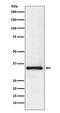 Small Nuclear Ribonucleoprotein Polypeptide A antibody, M08780-1, Boster Biological Technology, Western Blot image 