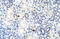 Zinc Finger And BTB Domain Containing 9 antibody, 29-155, ProSci, Immunohistochemistry paraffin image 
