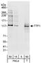 NK2 Homeobox 1 antibody, A302-361A, Bethyl Labs, Western Blot image 