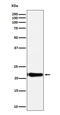 2'-Deoxynucleoside 5'-Phosphate N-Hydrolase 1 antibody, M08676, Boster Biological Technology, Western Blot image 