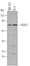 Immunoglobulin Superfamily Containing Leucine Rich Repeat 2 antibody, AF4650, R&D Systems, Western Blot image 