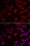 Preferentially Expressed Antigen In Melanoma antibody, LS-C334732, Lifespan Biosciences, Immunofluorescence image 