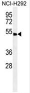 Abhydrolase Domain Containing 8 antibody, AP50027PU-N, Origene, Western Blot image 