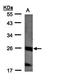 Nucleoside-Triphosphatase, Cancer-Related antibody, orb69954, Biorbyt, Western Blot image 