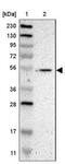 Glucocorticoid Modulatory Element Binding Protein 2 antibody, NBP1-81421, Novus Biologicals, Western Blot image 