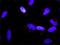 RAS Like Proto-Oncogene A antibody, H00005898-M01, Novus Biologicals, Proximity Ligation Assay image 