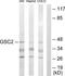 Goosecoid Homeobox 2 antibody, TA313977, Origene, Western Blot image 