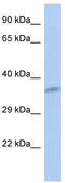 Carcinoembryonic Antigen Related Cell Adhesion Molecule 19 antibody, TA338409, Origene, Western Blot image 