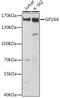 Platelet glycoprotein Ib alpha chain antibody, 16-397, ProSci, Western Blot image 