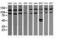 Phosphoinositide-3-Kinase Regulatory Subunit 5 antibody, LS-C174531, Lifespan Biosciences, Western Blot image 