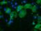 Serine/threonine-protein kinase D2 antibody, GTX83817, GeneTex, Immunofluorescence image 