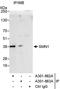 Survival Of Motor Neuron 2, Centromeric antibody, A301-862A, Bethyl Labs, Immunoprecipitation image 