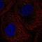DEAD-Box Helicase 6 antibody, NBP1-83249, Novus Biologicals, Immunocytochemistry image 