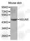 NOP2/Sun RNA Methyltransferase 5 antibody, A5992, ABclonal Technology, Western Blot image 