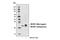 Mitochondrial Calcium Uniporter Regulator 1 antibody, 13706S, Cell Signaling Technology, Western Blot image 