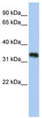 Glycine-N-Acyltransferase Like 3 antibody, TA331035, Origene, Western Blot image 
