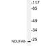 NADH:Ubiquinone Oxidoreductase Subunit A8 antibody, LS-C177474, Lifespan Biosciences, Western Blot image 