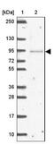 Nuclear pore complex interacting protein family member B3 antibody, NBP2-46813, Novus Biologicals, Western Blot image 
