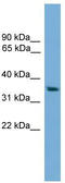 DNA repair protein RAD51 homolog 2 antibody, TA344637, Origene, Western Blot image 