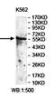 Zinc Finger And BTB Domain Containing 18 antibody, orb78015, Biorbyt, Western Blot image 