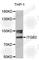 Integrin Subunit Beta 2 antibody, A2173, ABclonal Technology, Western Blot image 