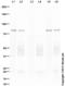 Neurotrophic Receptor Tyrosine Kinase 2 antibody, ab109684, Abcam, Western Blot image 
