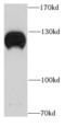 Nucleolar And Coiled-Body Phosphoprotein 1 antibody, FNab05790, FineTest, Western Blot image 