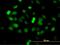 Zinc Finger Protein 182 antibody, MA5-20248, Invitrogen Antibodies, Immunofluorescence image 