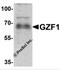 GDNF Inducible Zinc Finger Protein 1 antibody, 6793, ProSci Inc, Western Blot image 