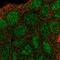 SHC Adaptor Protein 3 antibody, HPA072448, Atlas Antibodies, Immunofluorescence image 