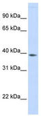 Family With Sequence Similarity 76 Member B antibody, TA340349, Origene, Western Blot image 
