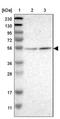 Chitotriosidase-1 antibody, NBP1-84490, Novus Biologicals, Western Blot image 