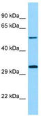 Serine/Threonine Kinase 33 antibody, TA331233, Origene, Western Blot image 