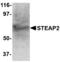 STEAP2 Metalloreductase antibody, TA306464, Origene, Western Blot image 