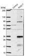 Regulator Of G Protein Signaling 17 antibody, PA5-54582, Invitrogen Antibodies, Western Blot image 
