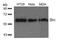 SRC Proto-Oncogene, Non-Receptor Tyrosine Kinase antibody, GTX50504, GeneTex, Western Blot image 
