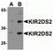 Killer cell immunoglobulin-like receptor 2DS2 antibody, NBP2-82102, Novus Biologicals, Western Blot image 