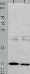 Gonadotropin Releasing Hormone Receptor antibody, TA321120, Origene, Western Blot image 