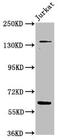 Tankyrase-1 antibody, CSB-PA024004LA01HU, Cusabio, Western Blot image 