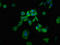 Regulator Of G Protein Signaling 1 antibody, LS-C674192, Lifespan Biosciences, Immunofluorescence image 