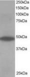 Oxysterol Binding Protein Like 1A antibody, TA302903, Origene, Western Blot image 