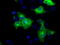 Golgi reassembly-stacking protein 1 antibody, TA501309, Origene, Immunofluorescence image 