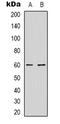 Nuclear RNA Export Factor 3 antibody, LS-C368909, Lifespan Biosciences, Western Blot image 
