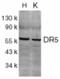 Death receptor 5 antibody, AHP488, Bio-Rad (formerly AbD Serotec) , Immunohistochemistry frozen image 