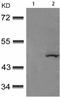 Glycogen Synthase Kinase 3 Beta antibody, TA323991, Origene, Western Blot image 