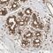 Zinc Finger Protein 397 antibody, NBP1-82753, Novus Biologicals, Immunohistochemistry paraffin image 